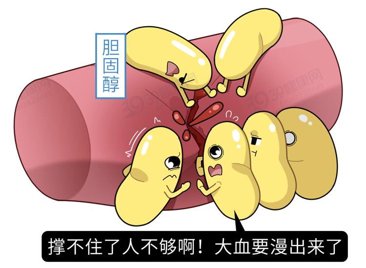血脂和胆固醇偏高能怎么预防,胆固醇血脂偏高怎么降下来