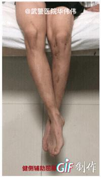 膝关节交叉韧带重建拄拐负重多少,膝关节后交叉韧带重建后康复训练