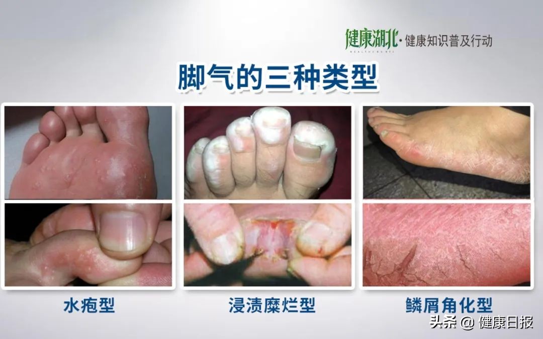 皮肤病的问题全在这里,皮肤病的10大问题