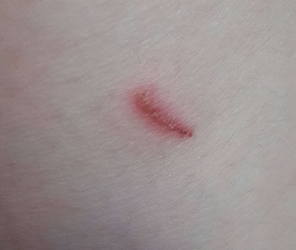 10种蛋白食物排行榜,100种蛋白质营养菜谱