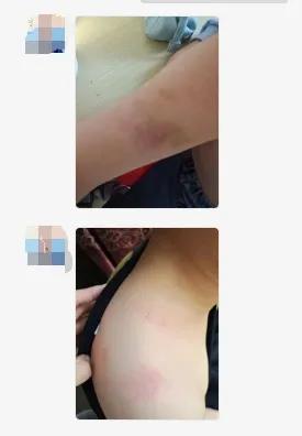 小学生在学校被老师掐脖子,熊孩子被妈妈掐脸蛋