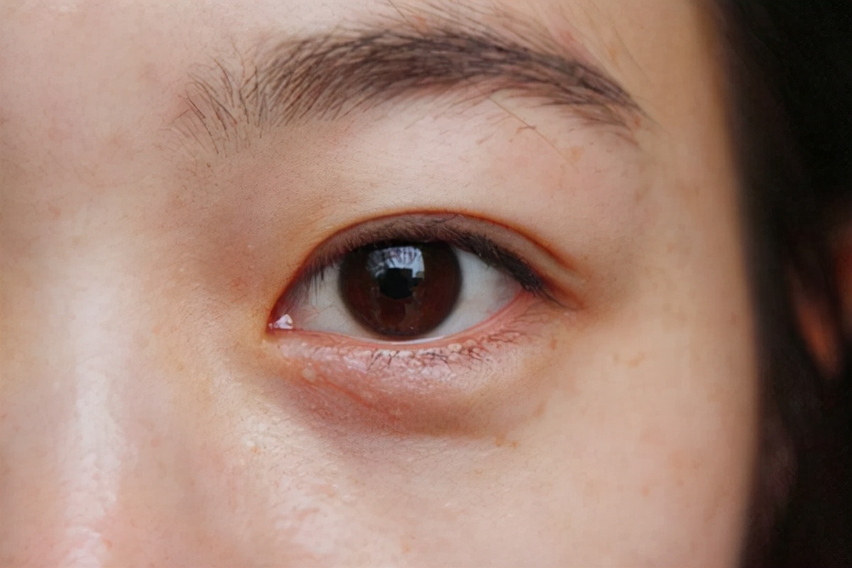 血虚的症状和中医治疗,血虚有哪些症状用什么药调