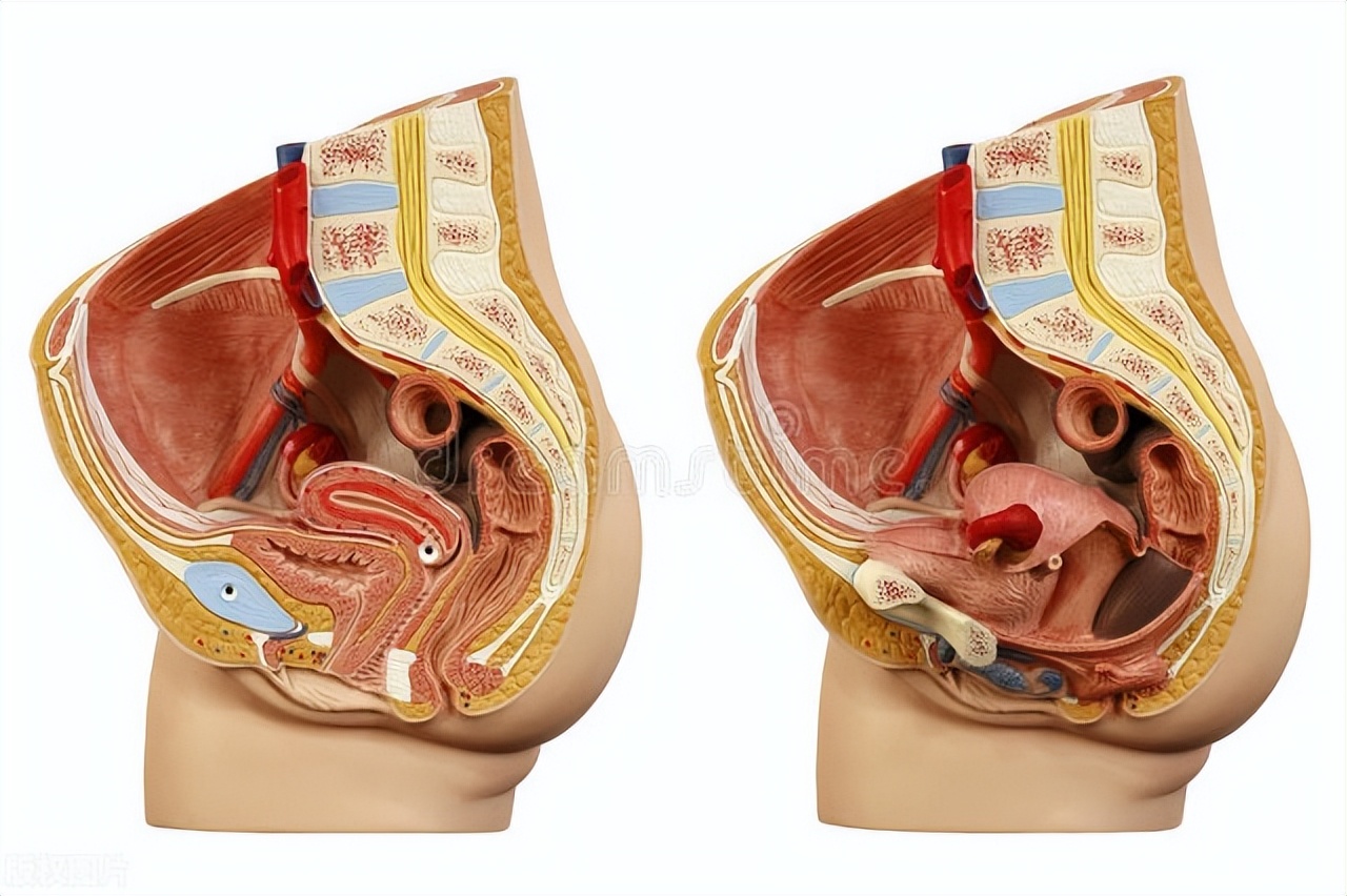 怎么改善骨盆前倾和翘臀,骨盆前倾与翘臀的区别