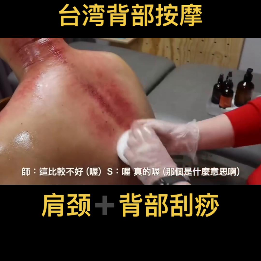沉浸式按摩背部刮痧,台湾背部刮痧