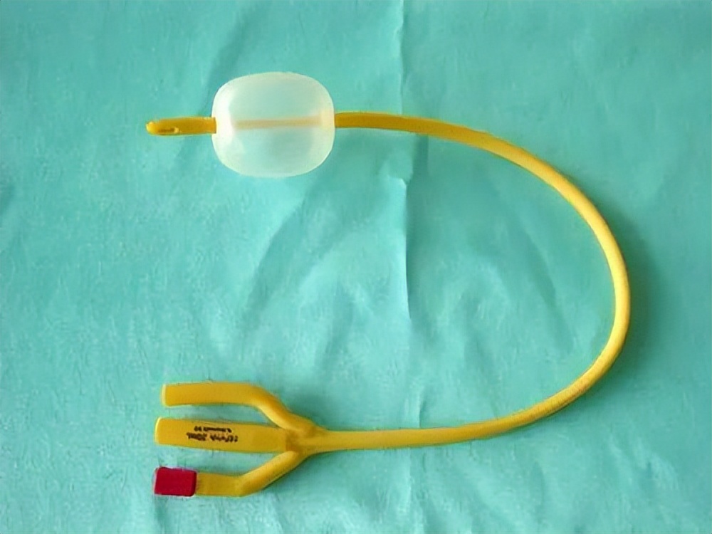 手术后插尿管是啥样的,手术插尿管是不是最后一步