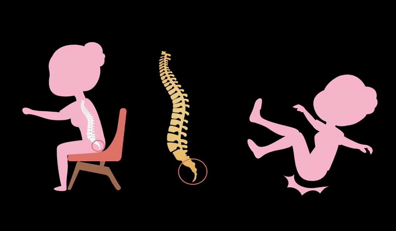 尾骨疼坐时间长了受不了,尾骨坐久会痛是什么原因