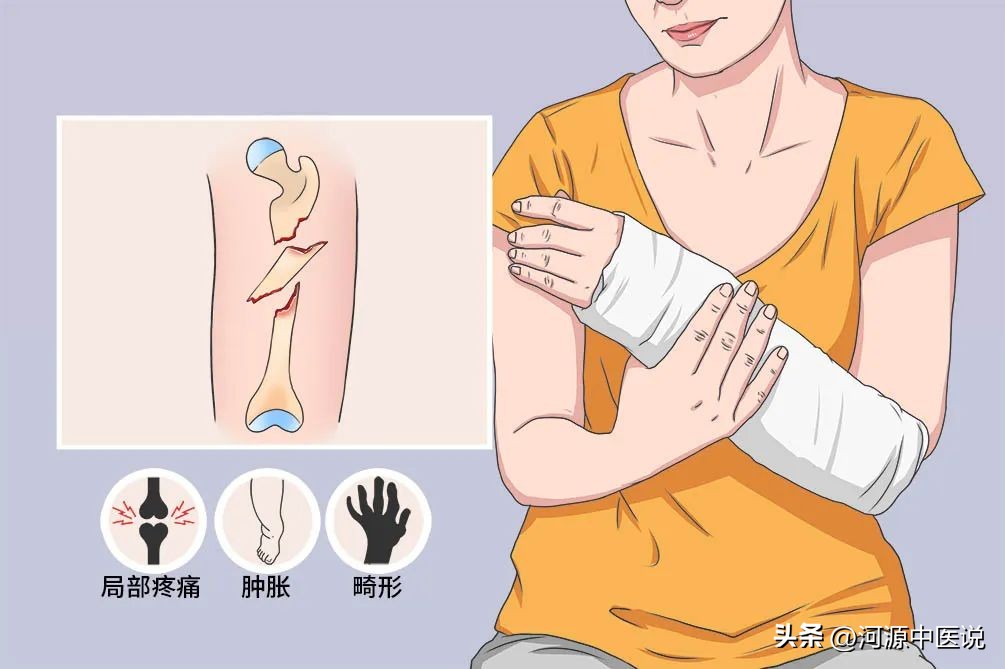 骨折后怎样消肿比较快,骨折后怎样消肿最快方法