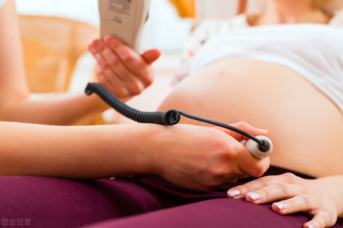 什么是监护胎心,胎心监护怎么做才顺利通过