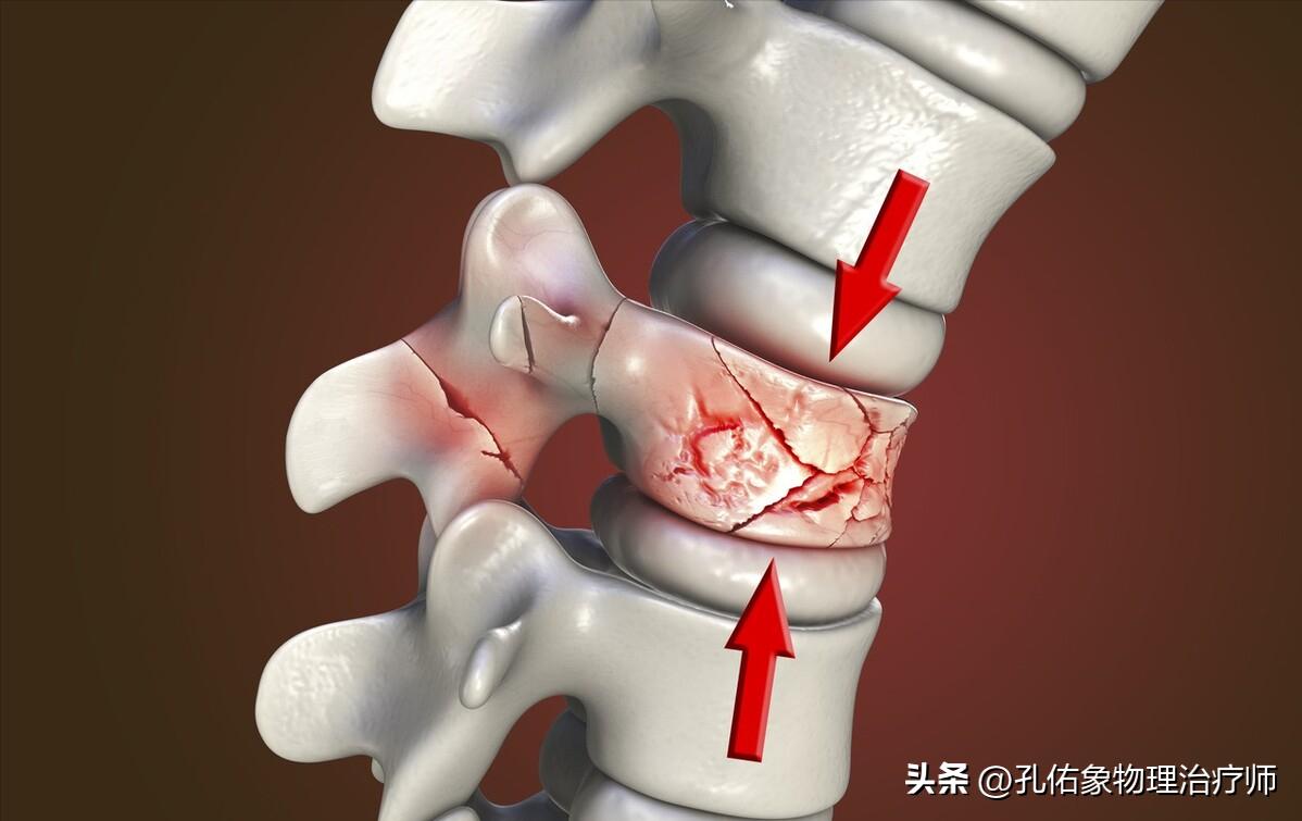 老年人腰部压缩性骨折怎么治疗,腰部压缩骨折多久才能恢复