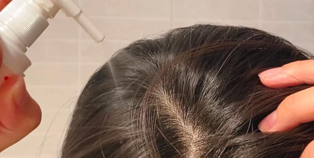 米诺地尔打卡第五天,米诺地尔每日打卡