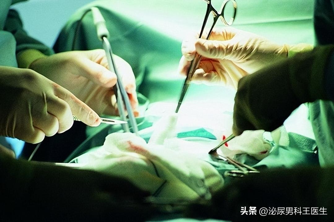 拉小便总是分叉男性,男性小便分叉怎么治疗