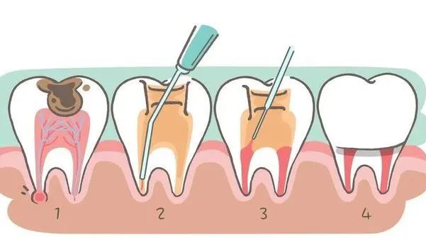 口腔牙龈内壁长硬包是上火吗,牙龈肿痛上火有个脓包怎么办