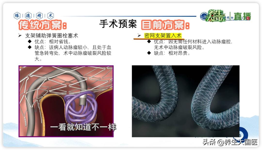 卒中危险因素有哪些,卒中全程管理