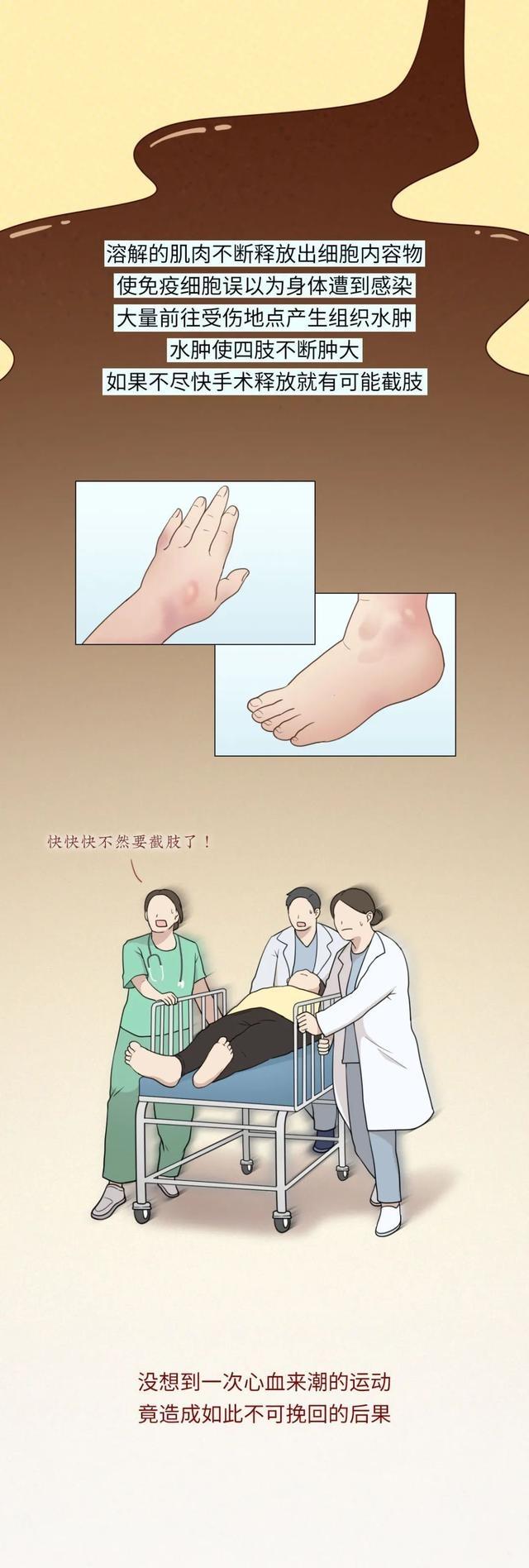 为什么跳跳绳会有大便的感觉,为什么跳完毽子操腿软