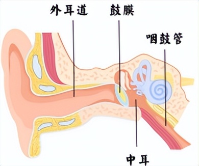 儿童分泌性中耳炎耳闷怎么缓解,儿童分泌性中耳炎怎么判断轻重