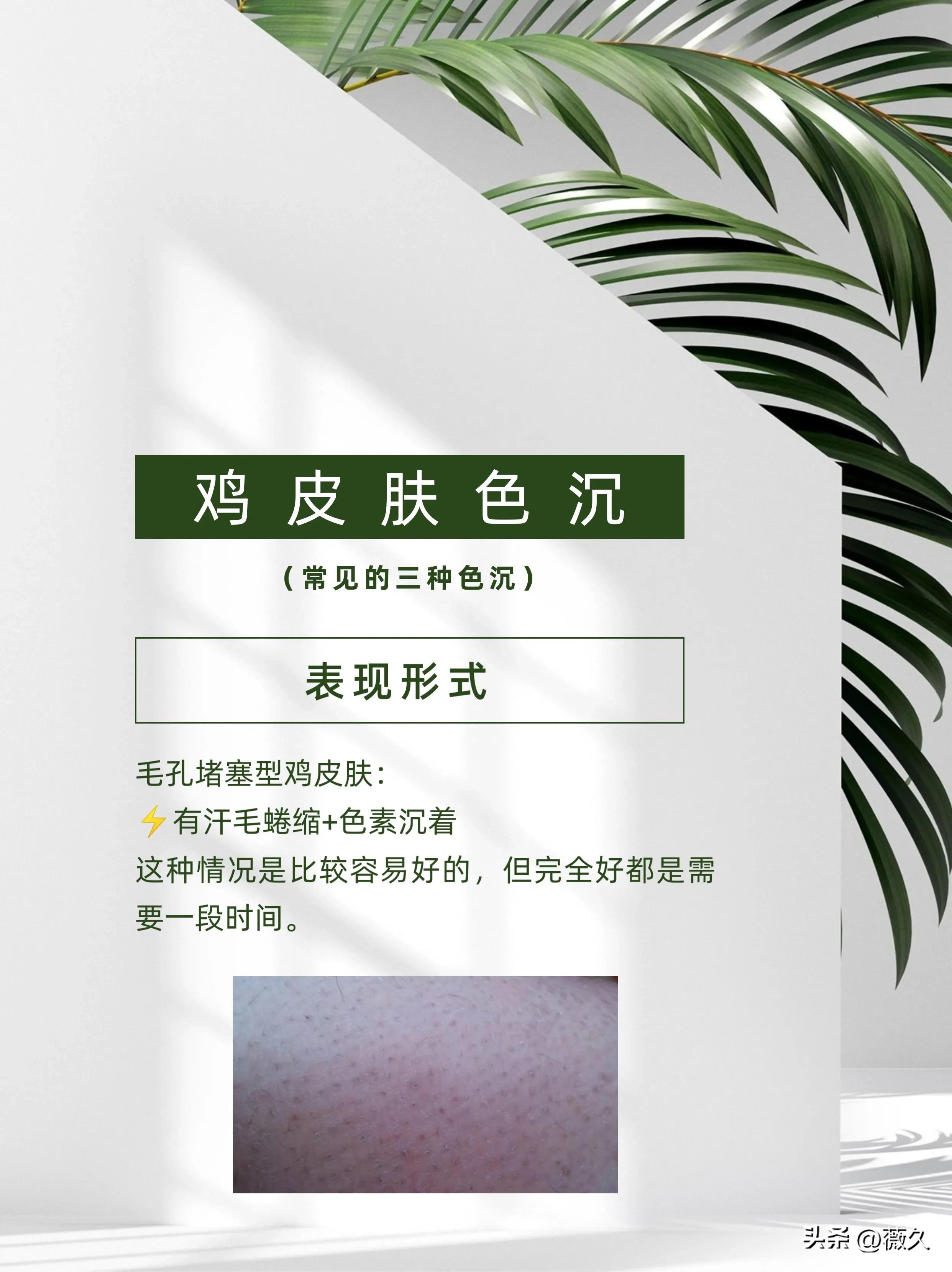 鸡皮肤必读!诱发因素+改善方法合集!