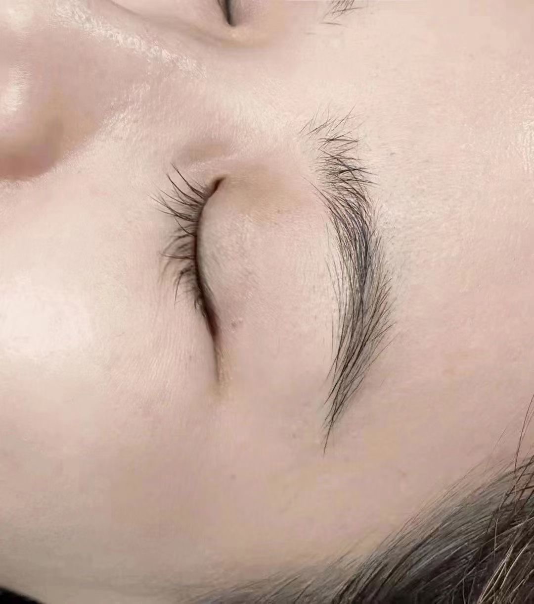 纹眉后红又肿怎么处理,半永久纹眉怎么预防变红