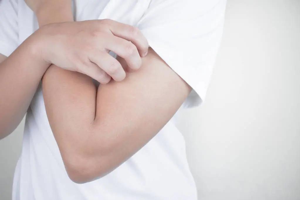 冬天皮肤干燥瘙痒用什么护肤品好,冬天皮肤干燥瘙痒一挠就起小疙瘩