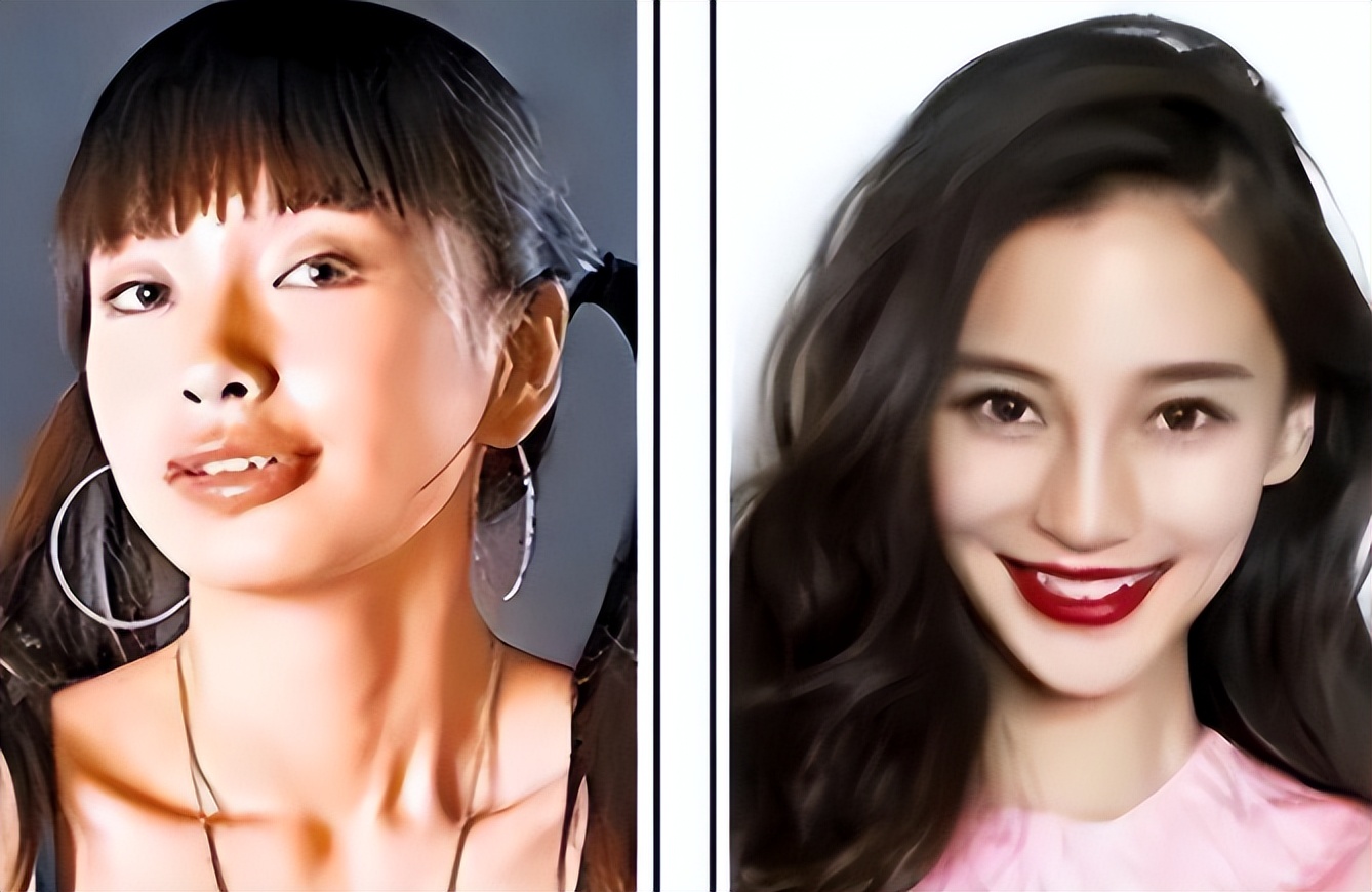 怎么不整容就能成为小v脸,不用整容也能变v脸吗