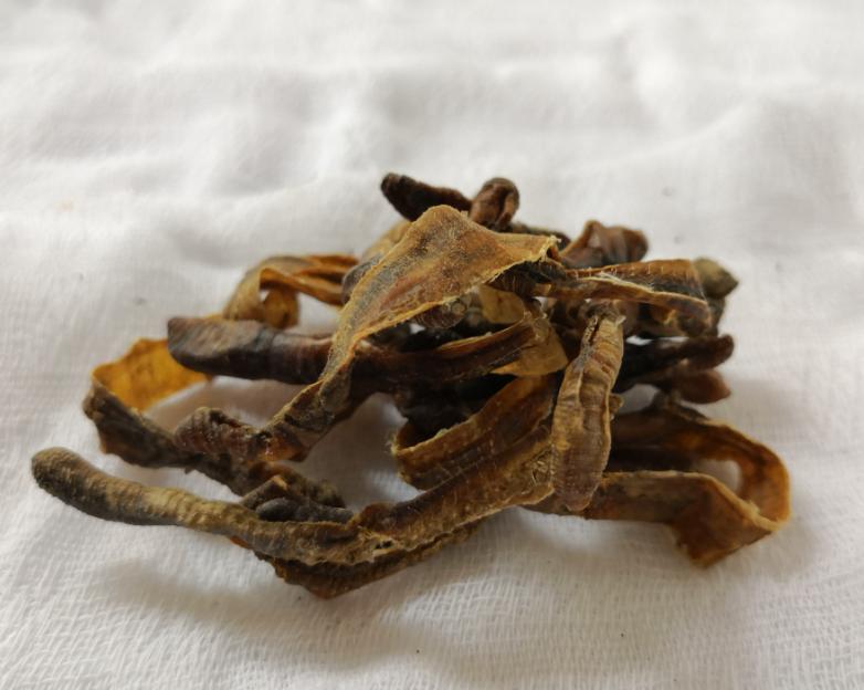 通过“脑之玄府”理论，来谈谈脑梗死的中医辨治思路