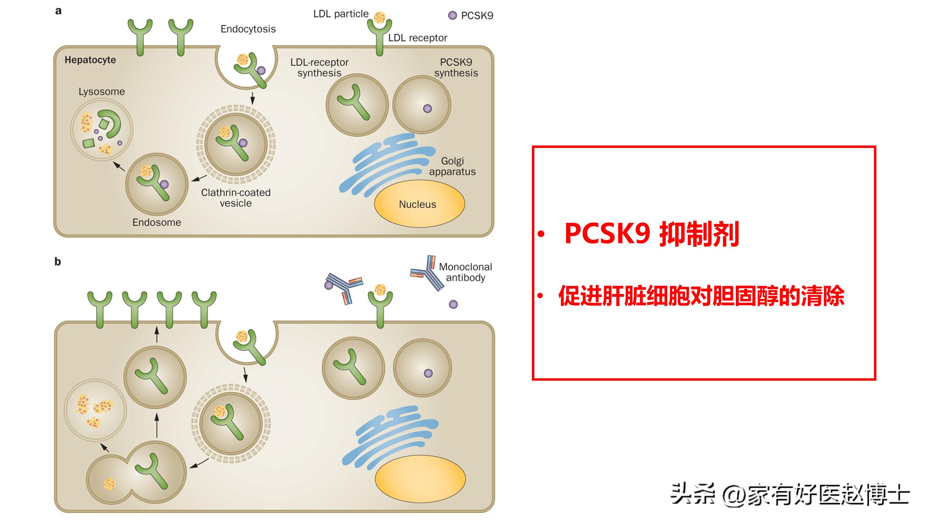 胆固醇高喝什么茶辅助降,胆固醇多高才需要用药