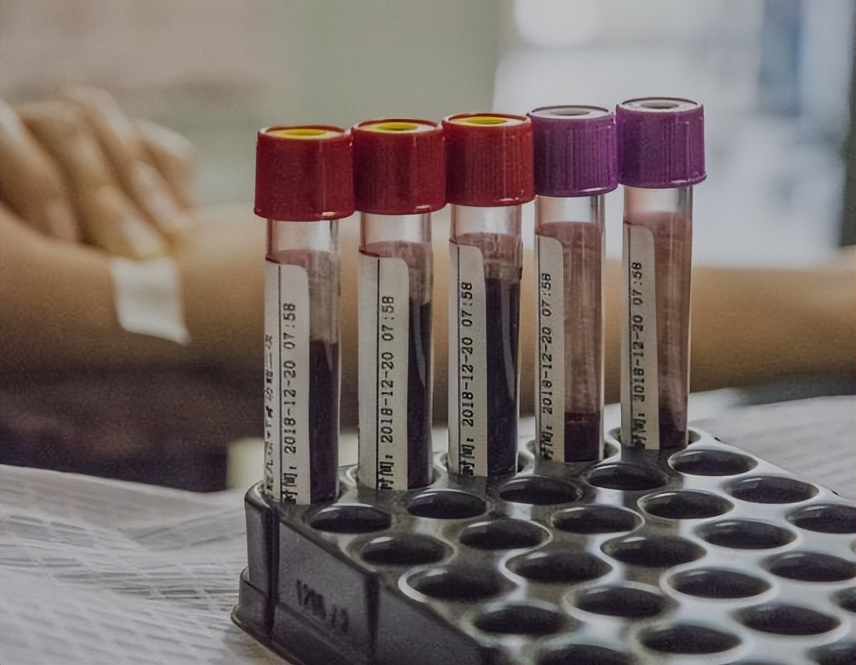 血常规指标高或低多少会有危险,血常规检查3项高有什么病