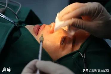 做双眼皮20天大小眼,做双眼皮二十几岁做最好