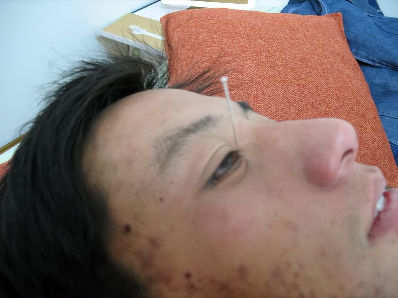 表情不受管理怎么办,表情不受控制是什么病