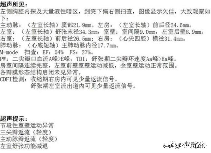 胸导联低电压危害,胸导联低电压临床意义