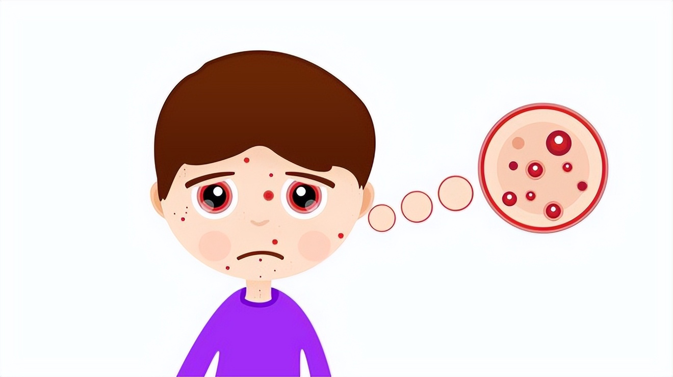 痘痘怎么护理和消除,痘痘怎么自然养好