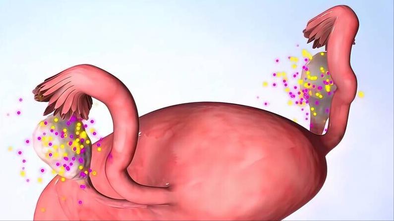 医生能看出黄体破裂的原因吗,什么症状可以判定是黄体破裂