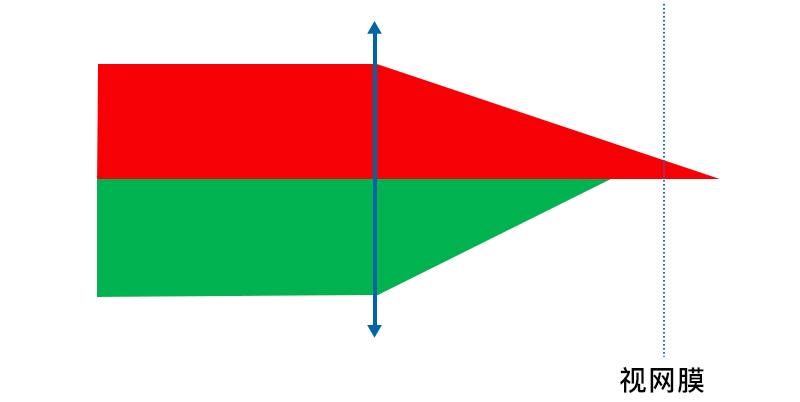 视力1.75还能恢复吗,视力1.75近视算严重吗