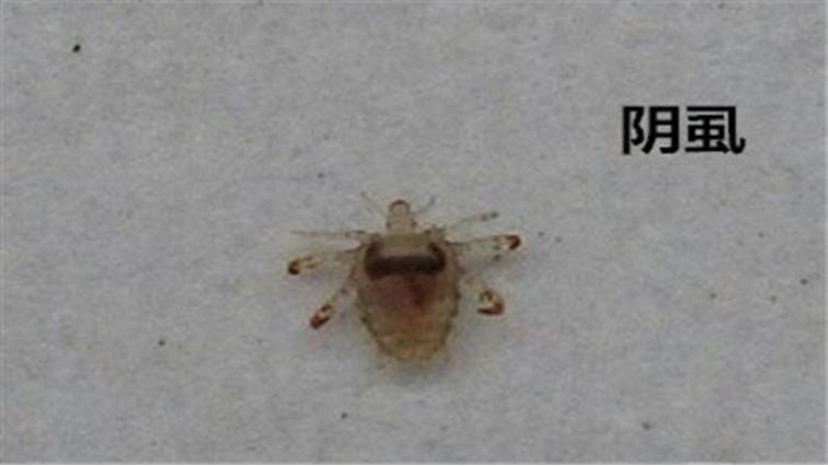 男子腹部痒,男性大量阴虱和虫卵