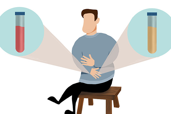 前列腺钙化是得癌的前兆吗,前列腺钙化是癌的前兆吗