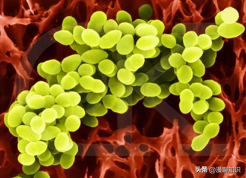 牦牛是高山地区牛的独特品种，肉质鲜嫩，但却饱受葡萄球菌的侵害