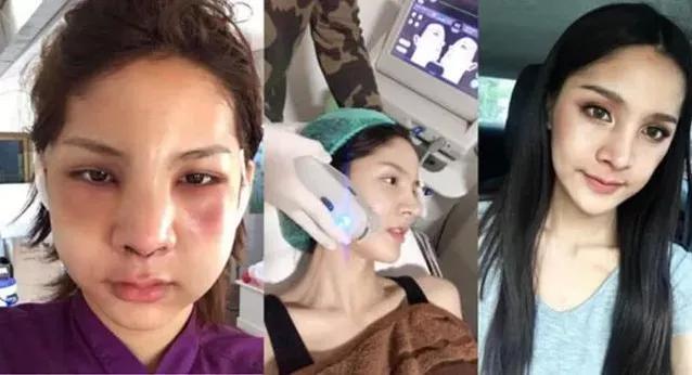 韩国小哥在中国长大回韩国服兵役,韩国小哥为了躲避服兵役变性