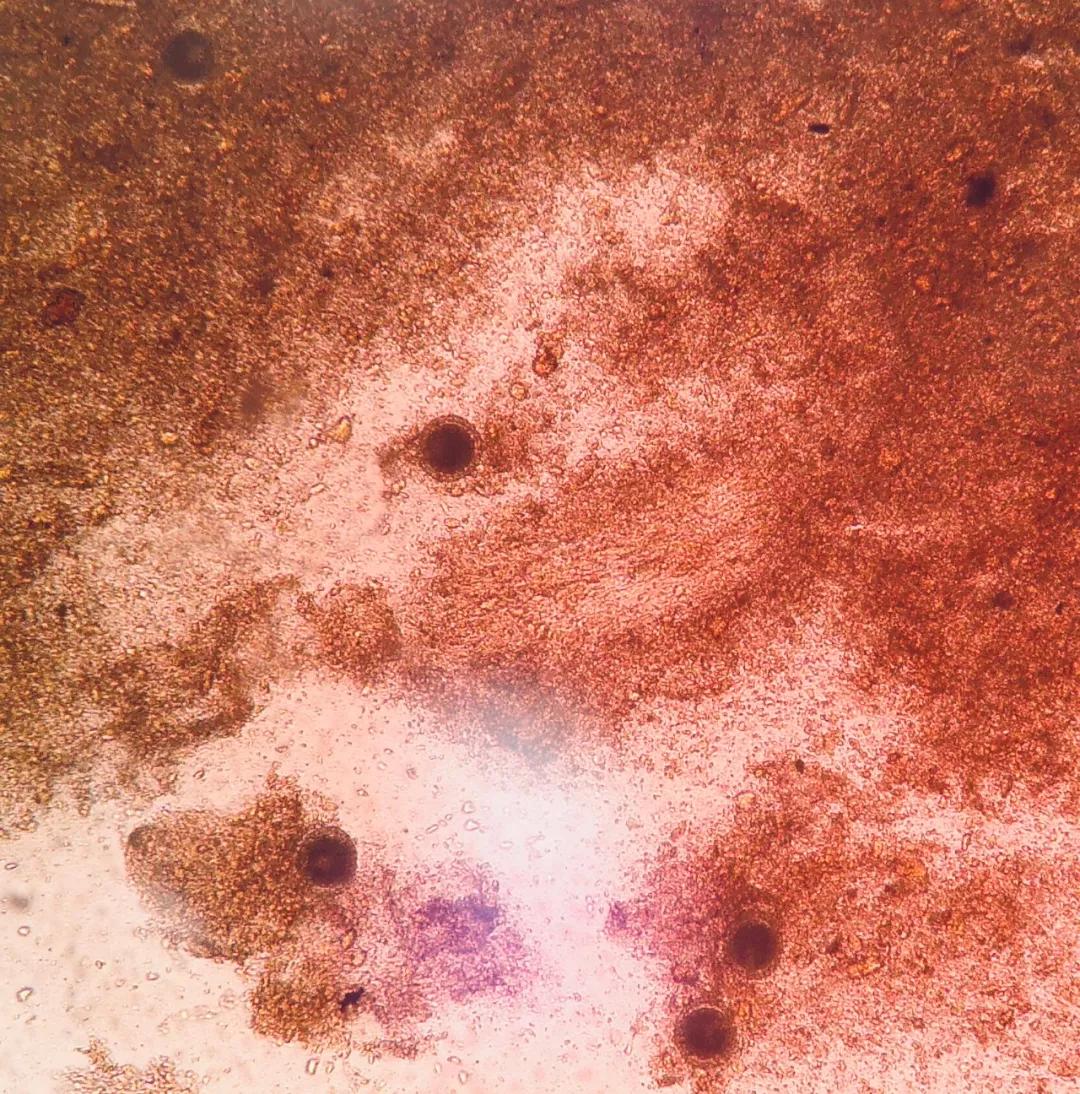 宠物驱虫药吃了多久排虫,宠物吃了驱虫药以后要注意什么