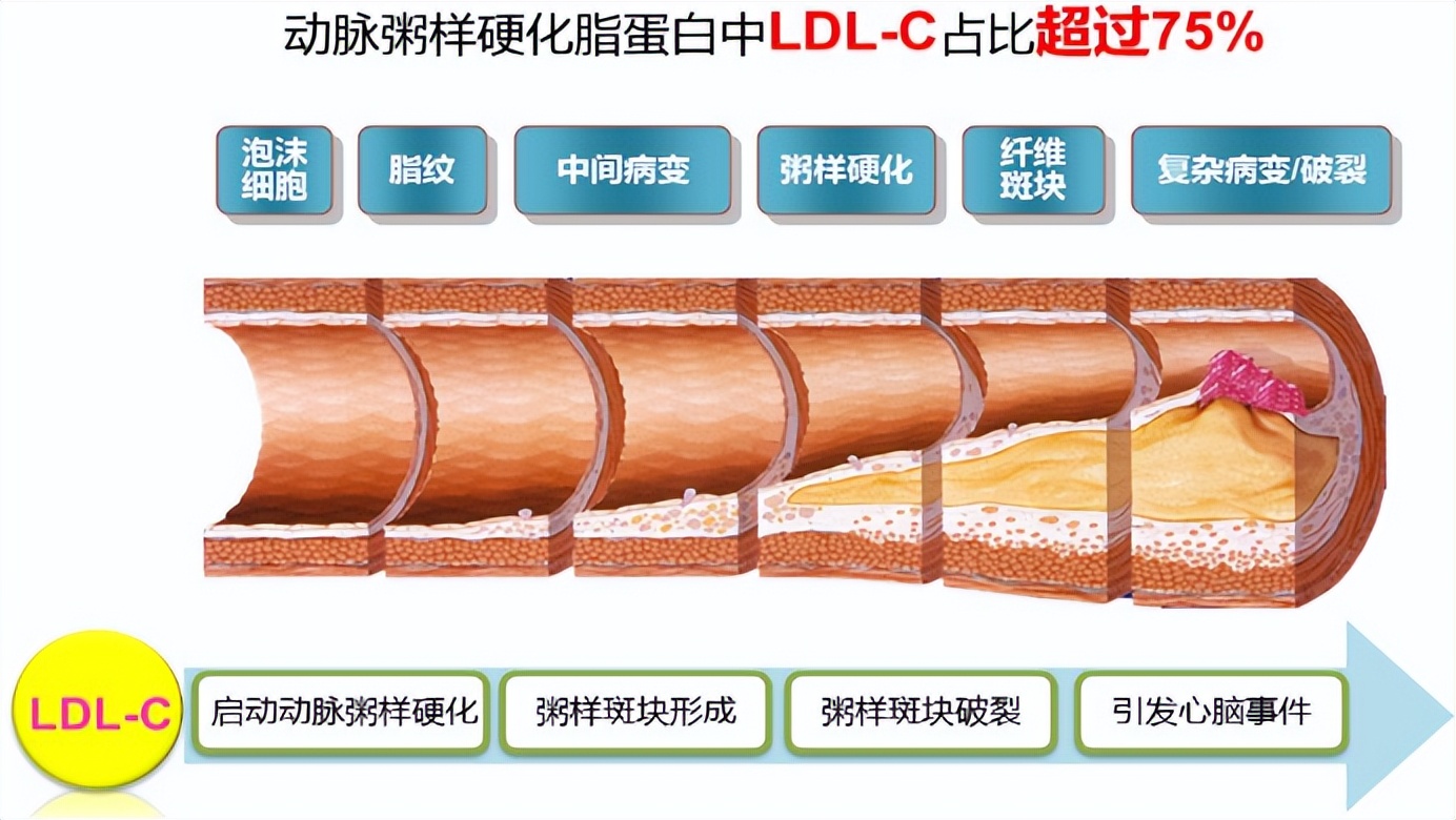 心脏病到底能不能吃伟哥,吃伟哥能造成心脏病吗