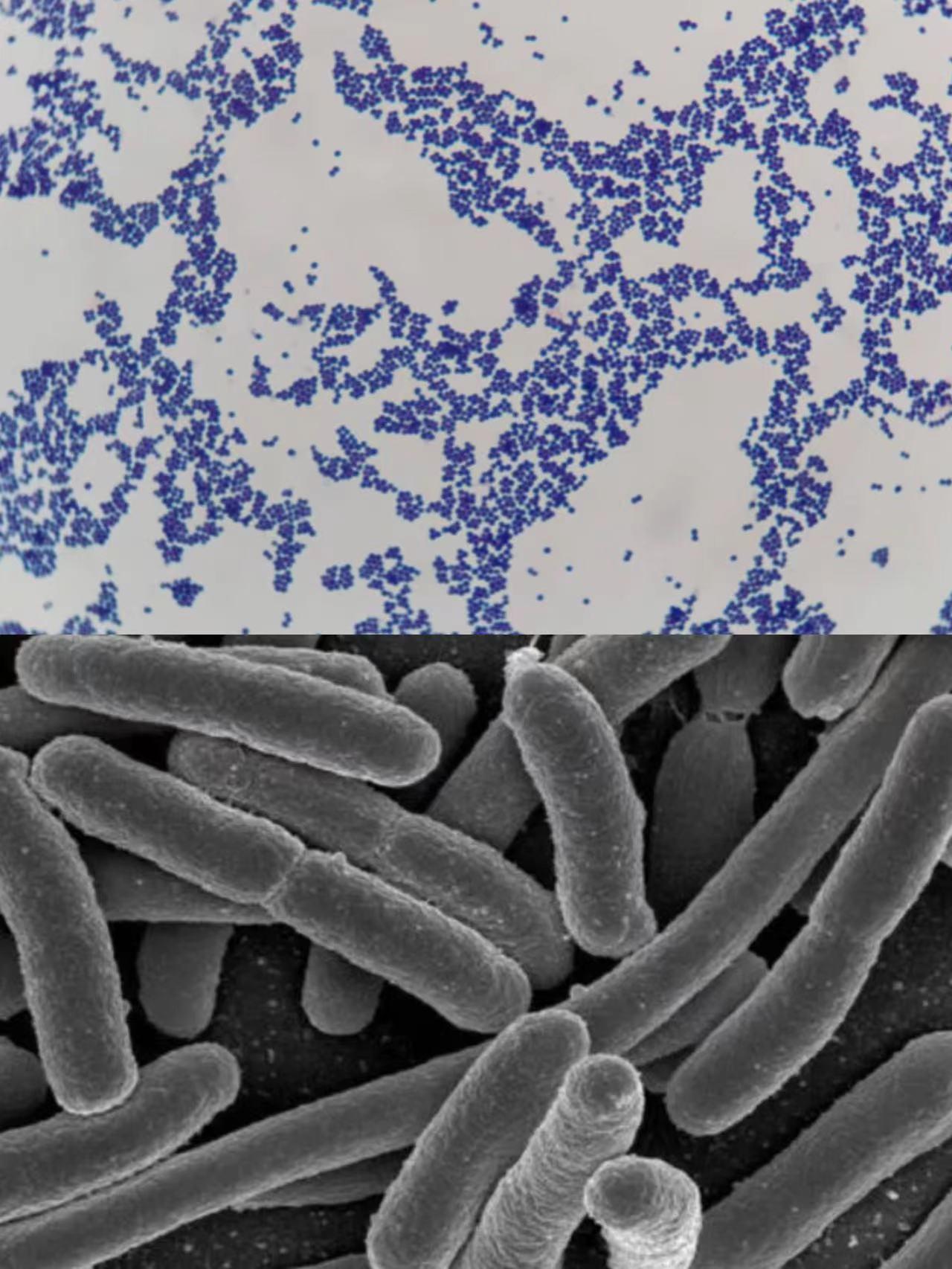 潜藏在不孕背后的“隐形杀手”？山东医生：都是盆腔炎惹的祸