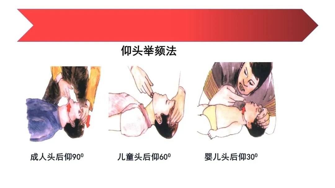 人工呼吸与心肺复苏操作方法ppt,心肺复苏技术ppt2021