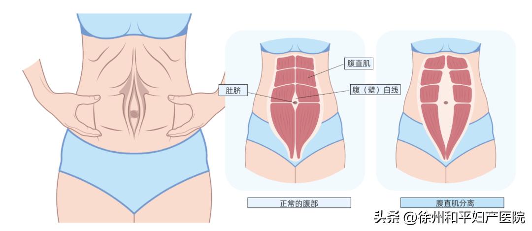 怀孕生娃会长个子吗,怀孕生子真的能长高吗