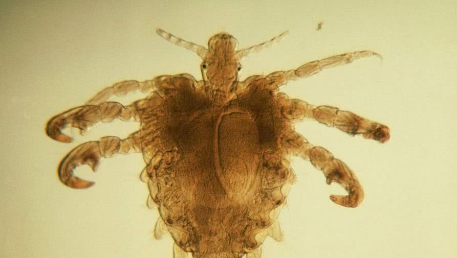 阴虱是个人的毛病吗,阴虱的源头是哪里来的怎么治