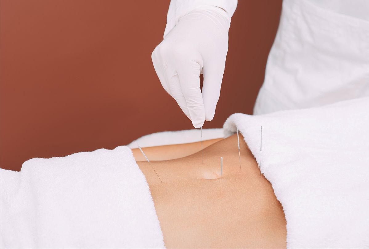 中医针灸治疗腰痛病的学术思想,古法针灸临床治验