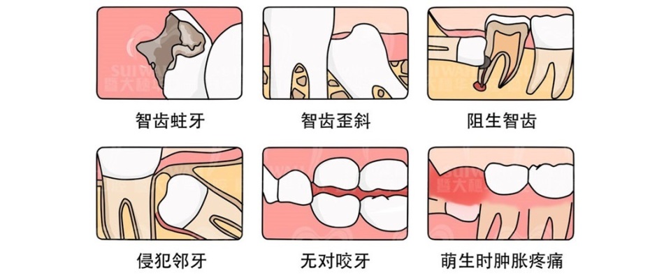 牙疼怎么辨别是哪种牙病,牙疼怎么判断是上火还是有炎症
