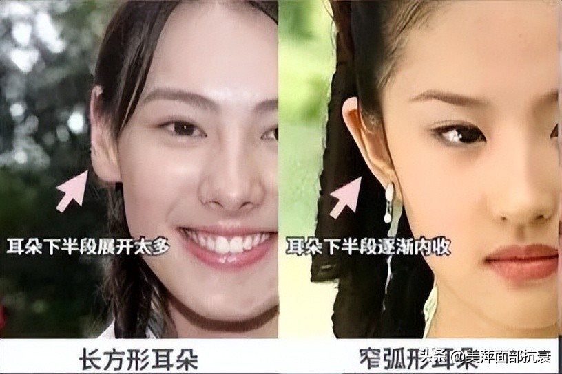 耳朵怎样才能变得更好看,如何改善耳朵好看