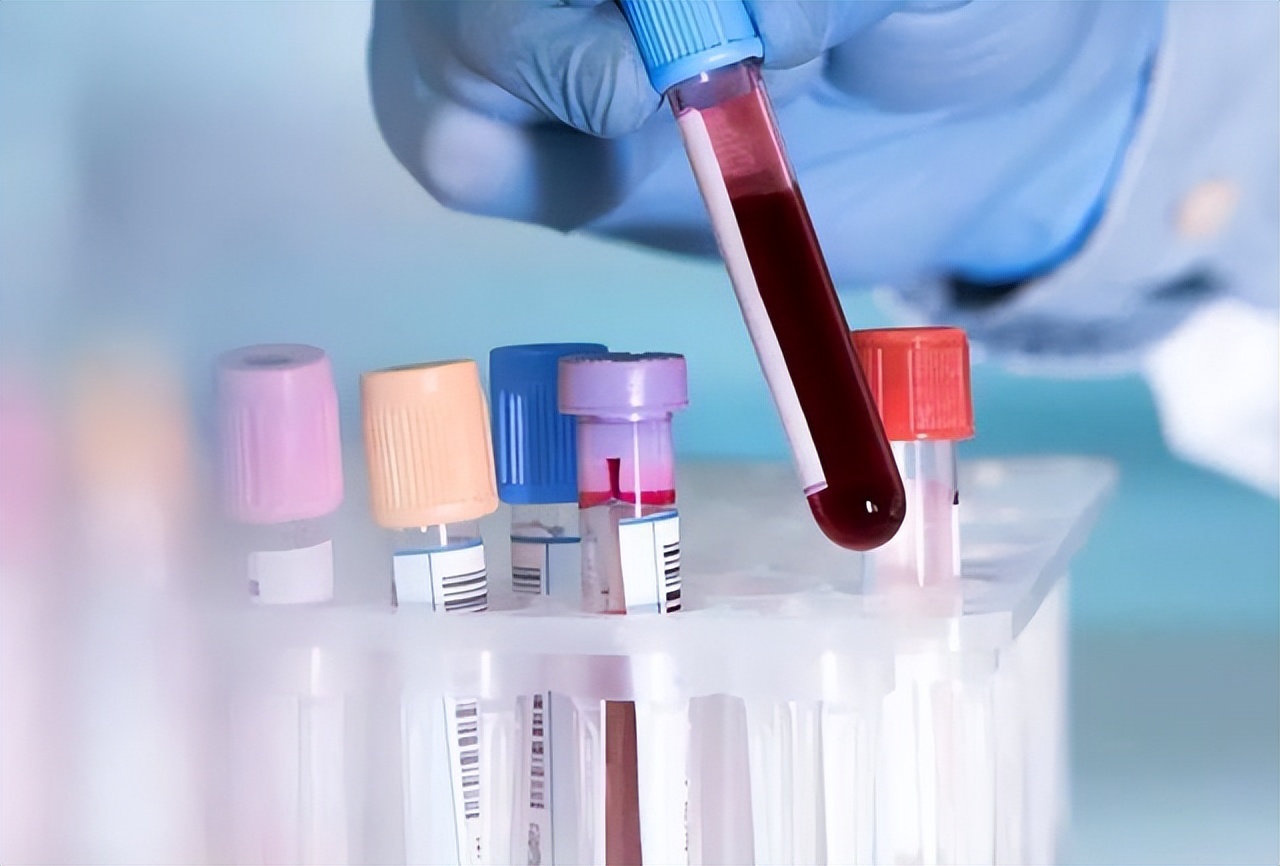 为什么痛风什么都注意了还会发作,为什么痛风用药反而更严重了