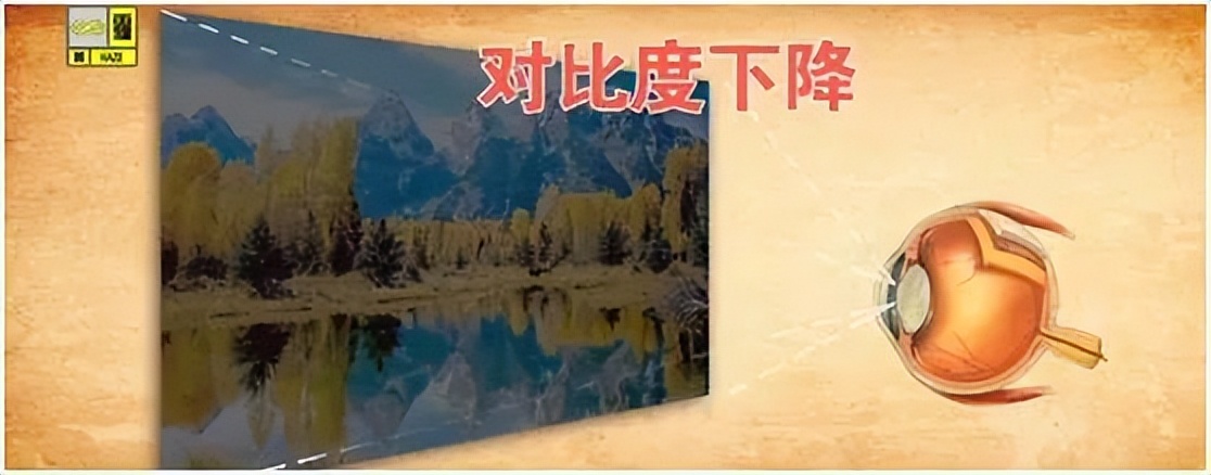 警惕四种致盲眼疾,中老年人要预防这些致盲性眼疾