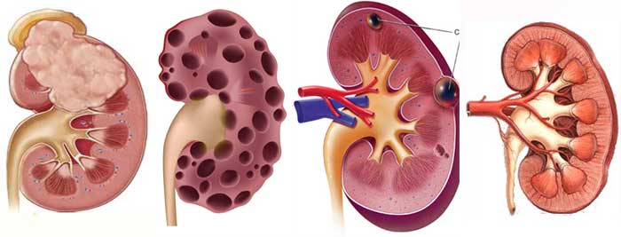 泌尿外科门诊常见病及治疗方案,泌尿外科疑难问题解析