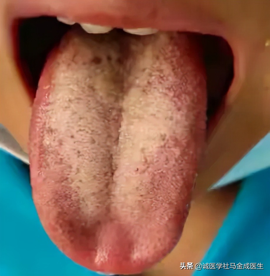 一吃凉的就胃痛食疗方法,吃了凉性食物胃痛怎么缓解