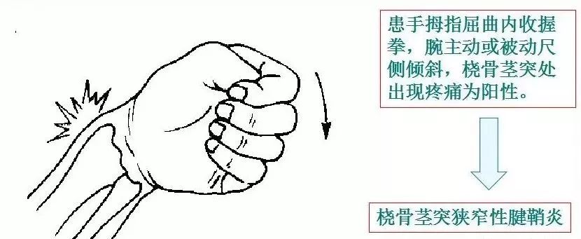 常见运动损伤及处理方法教案,体育课常见运动损伤及处理